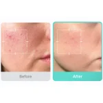 سرم آزلاییک‌اسید ۱۶٪ مدیکیوبMedicube Azelaic Acid 16% BB