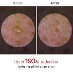 آمپول پیل شات روشن‌کننده برنج دکتر ملاکسین Dr. Melaxin Peel Shot Exfoliant Rice Ampoule