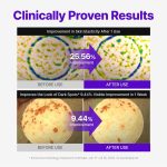 کرم ترمیم‌کننده و بازسازی‌کننده سد دفاعی پوست سنتلیان 24 مدل Expert Madeca Cream PDRN